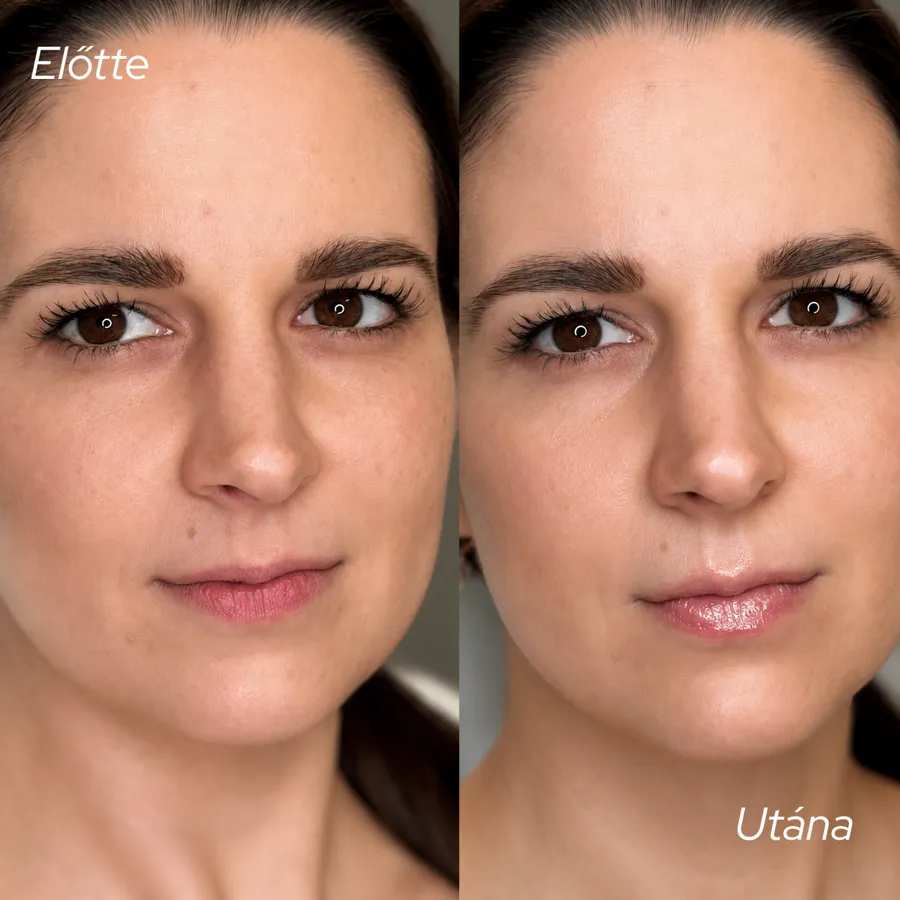 Előtte–utána 1