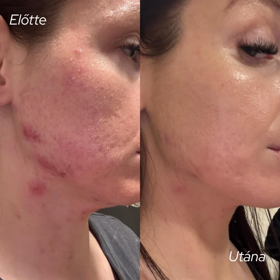 Előtte–utána 2