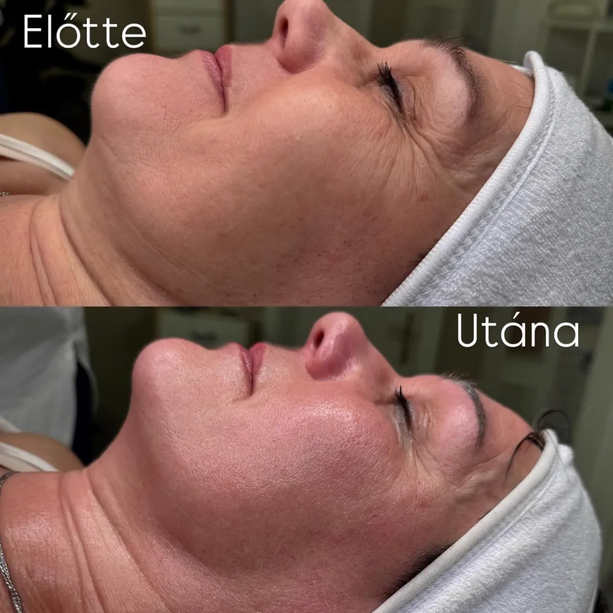Referencia 9: előtte és utána
