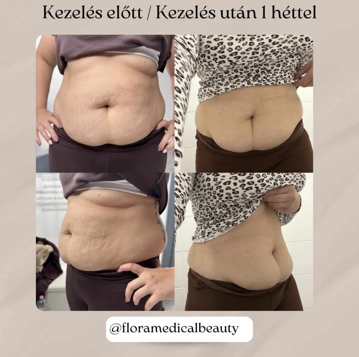 Referencia 10: előtte és utána