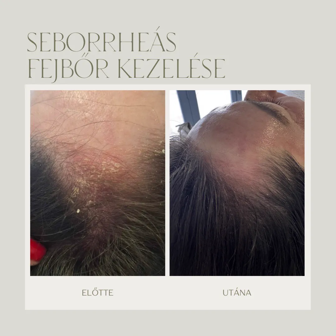 Referencia 16: előtte és utána
